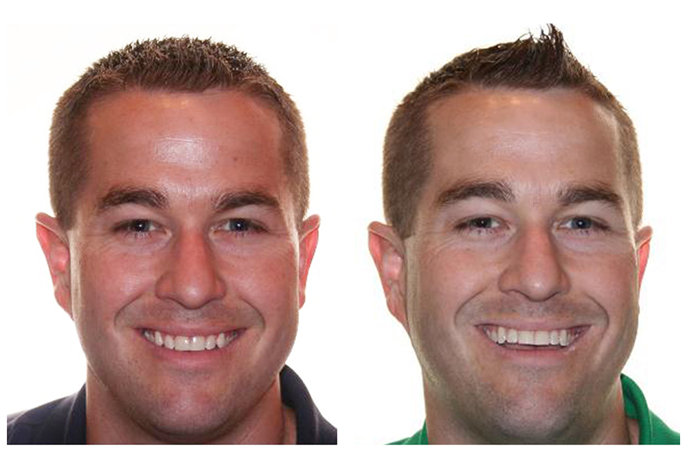 Modern Dental Care of Queens