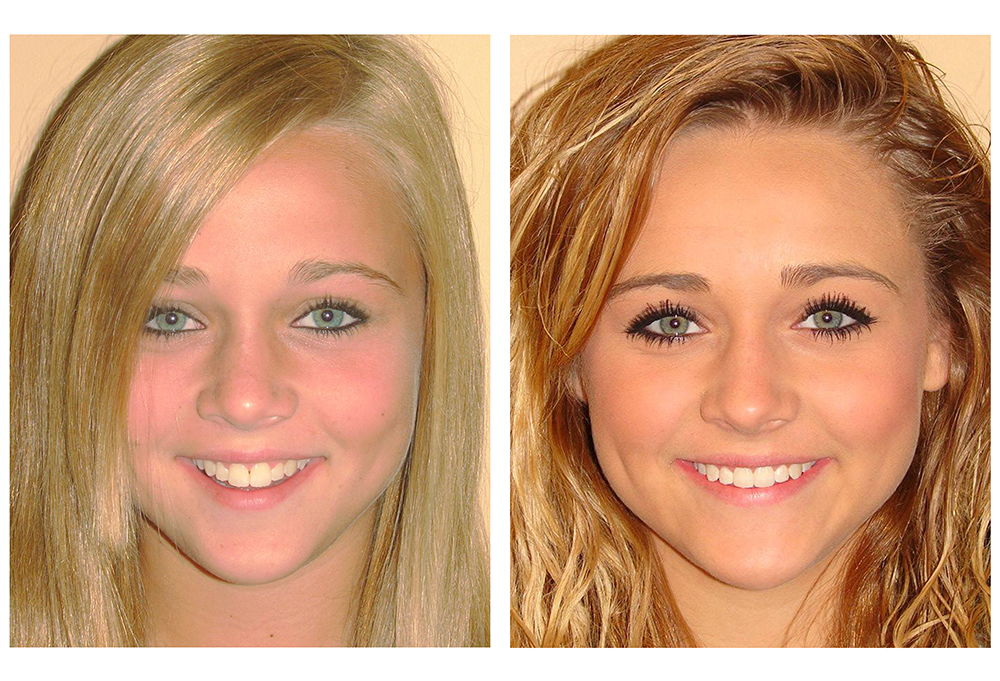 Modern Dental Care of Queens