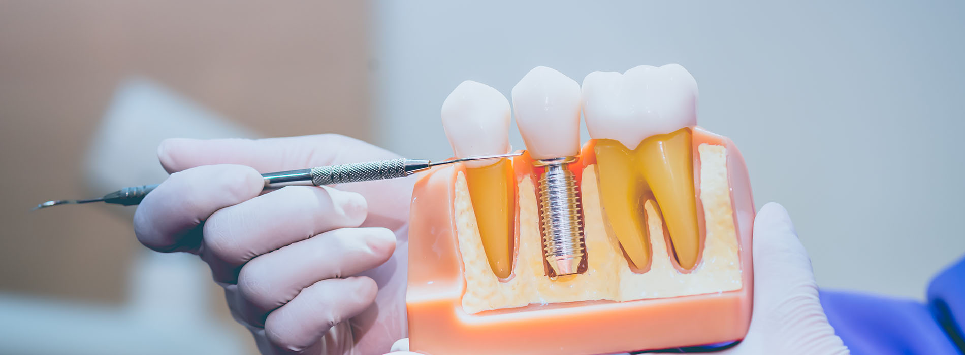 Modern Dental Care of Queens | Cosmetic Dentistry, Dental Fillings and CEREC